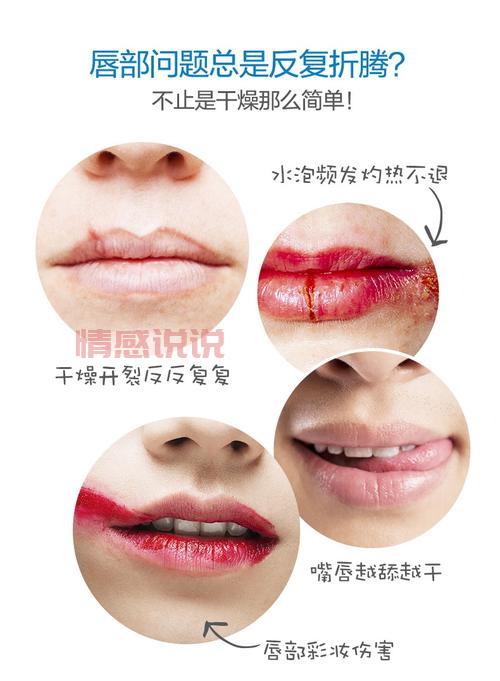 保湿必备！依泉特润滋润唇膏的护唇秘诀