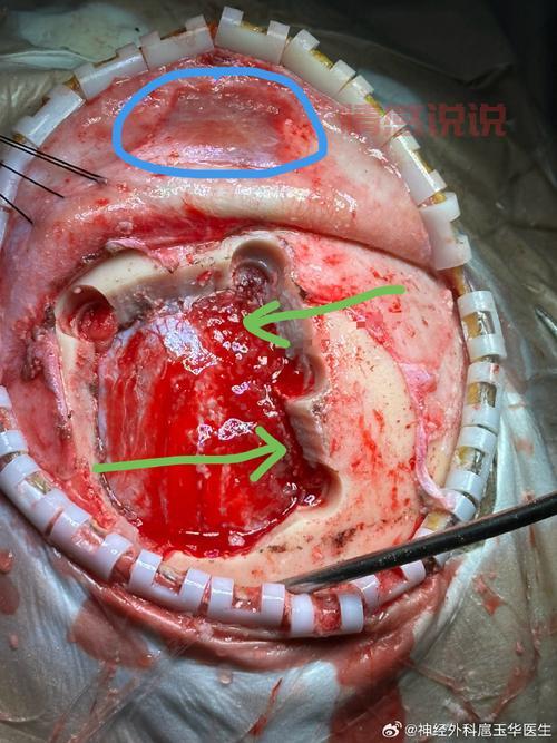 石家庄神经科医院哪家好？优选推荐与排名