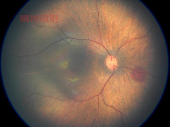邯郸信息港新生儿筛查有必要做吗？听听专家怎么说